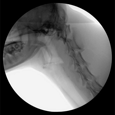 Fluoroscopy